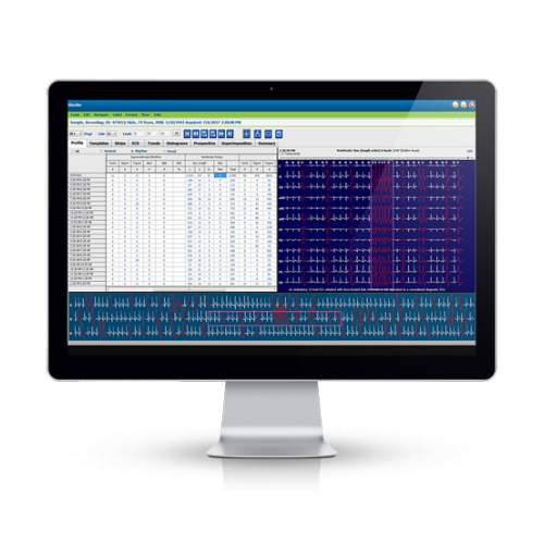 HScribe-holter-system